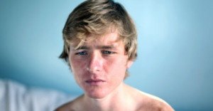 I Nagroda 53. edycji World Press Photo w kategorii: Portraits Singles, Laura Pannack, United Kingdom, Lisa Pritchard Agency for The Guardian Weekend magazine, Graham, anorexic teenager
